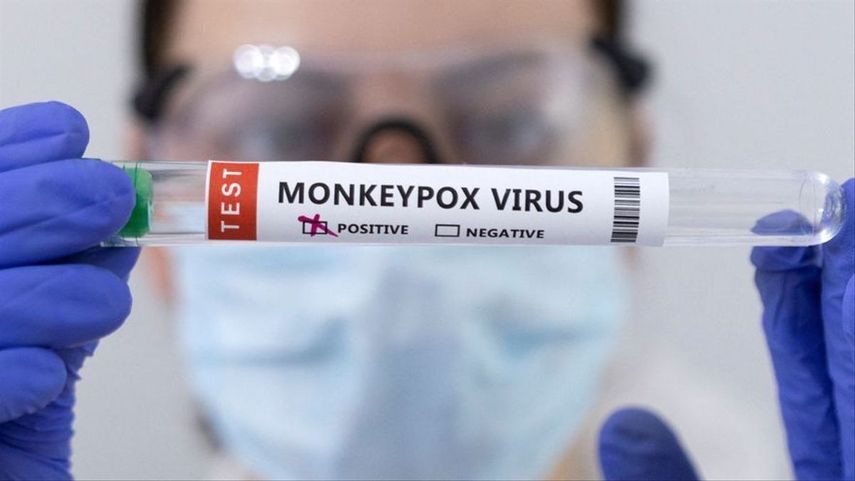 El Ministerio de Salud (MINSA) a través de la Dirección de Salud Pública informó este lunes que se amplía la aplicación de la vacuna contra la Viruela Símica con el fin de poder abarcar la mayor población de riego en todas sus instalaciones de Salud.