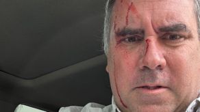 El candidato presidencial del partido peruano Libertad Popular, el empresario Rafael Belaúnde Llosa, sobrevivió este martes a un atentado tras ser atacado a tiros cuando se desplazaba por el distrito de Cerro Azul, en el sur de Lima, Perú, según denunció un portavoz de su movimiento político.