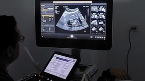 Caja de Seguro Social destaca avances en la atención materno-fetal en Ciudad de la Salud