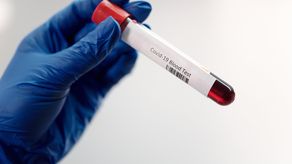 Minsa confirma 766 casos positivos de covid durante la última semana