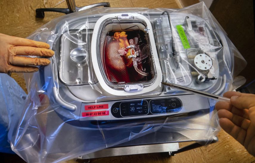 Científicos generan riñones similares a humanos en cerdos