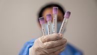 Argentina pone a disposición pruebas de hantavirus Argentina pone a disposición pruebas de hantavirus