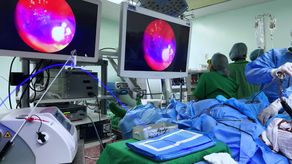 CSS utiliza equipo láser azul por primera vez en Latinoamérica