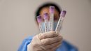 Argentina pone a disposición pruebas de hantavirus