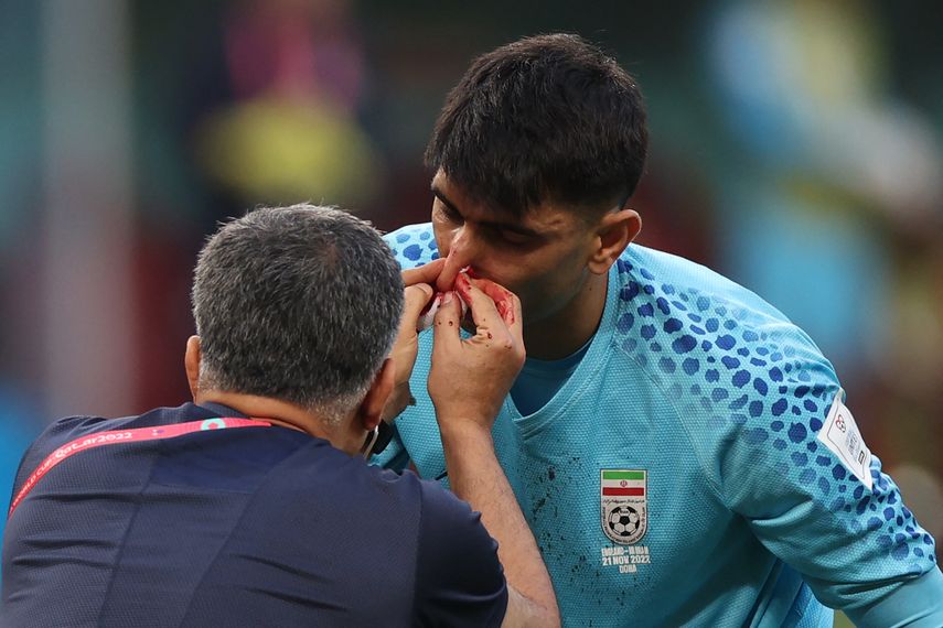 Irán: El duro golpe que recibió su arquero