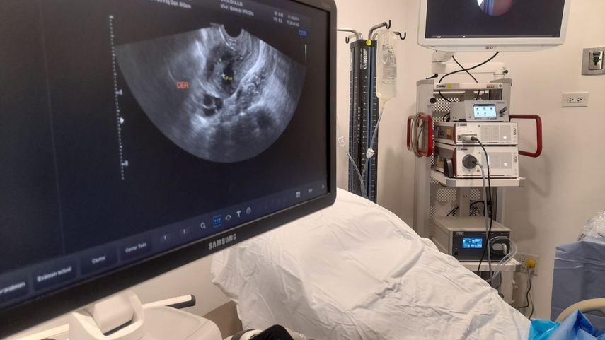 Los procedimientos permiten diagnósticos benignos y pre-malignos más certeros en la Ciudad de la Salud. Los procedimientos permiten diagnósticos benignos y pre-malignos más certeros en la Ciudad de la Salud.