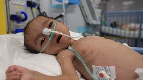 Expertos en alimentación advierten sobre inminente hambruna en el norte de Gaza