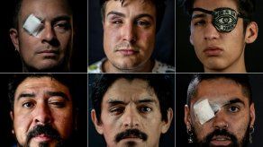 Relatos de heridos oculares en la revuelta en Chile