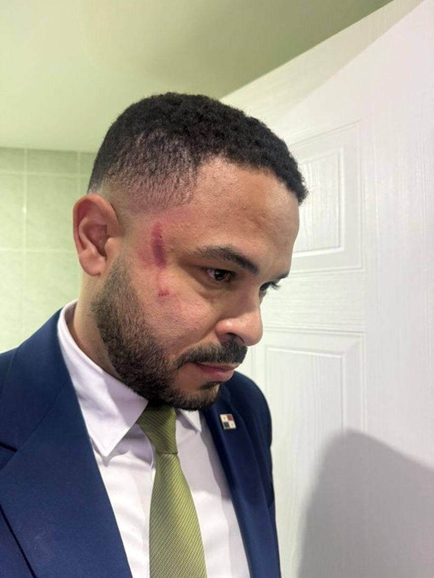 Agresión en la Asamblea Nacional. Diputado Jairo Salazar golpeó a Betserai Richards