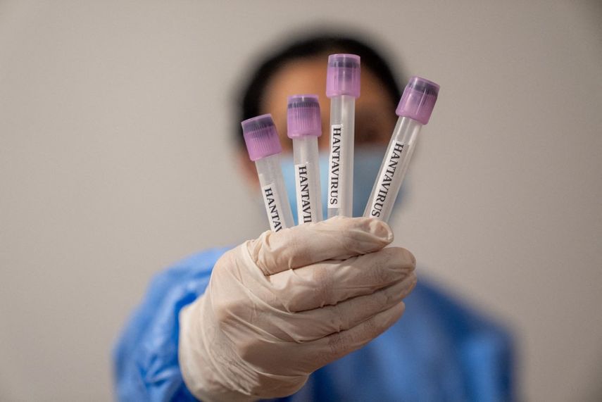 Argentina pone a disposición pruebas de hantavirus