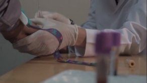 Hepatitis viral causa 1