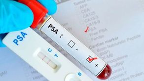 La detección temprana es una de las principales herramientas para identificar oportunamente el cáncer de próstata, por lo que el Ministerio de Salud (Minsa) instó a los hombres a mantener sus controles médicos y consultar ante factores de riesgo o alteraciones que requieran evaluación.