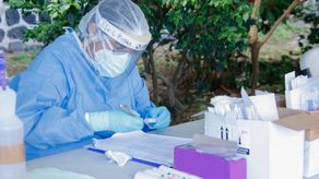 MINSA confirma 26 casos de la variante ómicron