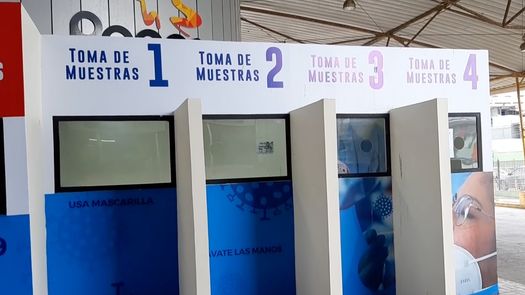 El Minsa indicó que el equipo de vigilancia epidemiológica se mantiene alerta por viruela símica desde fines del pasado mes de mayo, principalmente por ser una región fronteriza.