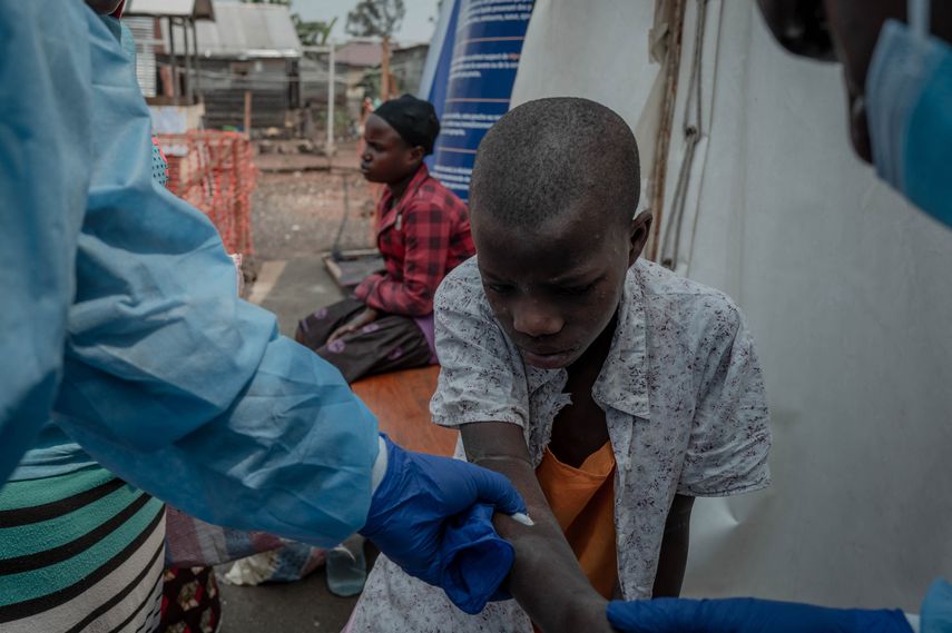 Más de 18 mil casos de viruela del mono en África desde principios de año