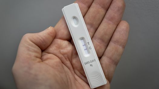 MINSA: resultado de prueba casera covid deberá estar en app