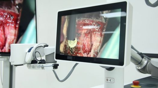 El Hospital Luis Chicho Fábrega dio un paso significativo en la modernización de los servicios de salud con la incorporación de un exoscopio quirúrgico digital asistido por robot, tecnología que permitirá realizar procedimientos con mayor precisión en el interior del país. El Hospital Luis Chicho Fábrega dio un paso significativo en la modernización de los servicios de salud con la incorporación de un exoscopio quirúrgico digital asistido por robot, tecnología que permitirá realizar procedimientos con mayor precisión en el interior del país.