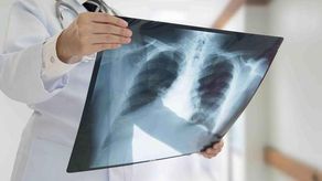 Panamá logró avances relevantes en la lucha contra la tuberculosis durante 2025, al registrar una reducción tanto en la tasa de incidencia como en la mortalidad asociada a esta enfermedad, informó el Ministerio de Salud (Minsa).