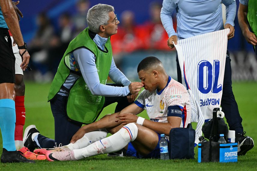 Mbappé sufre fractura de nariz.