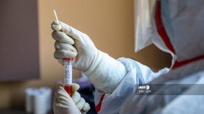 Rusia anuncia ensayo en animales de vacuna contra el coronavirus