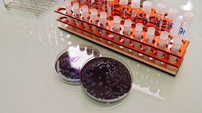 Argentina: quinta muerte por una bacteria que causa neumonía