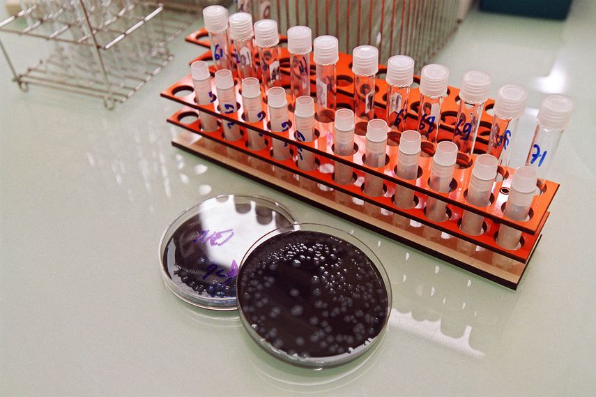 Argentina: quinta muerte por una bacteria que causa neumonía