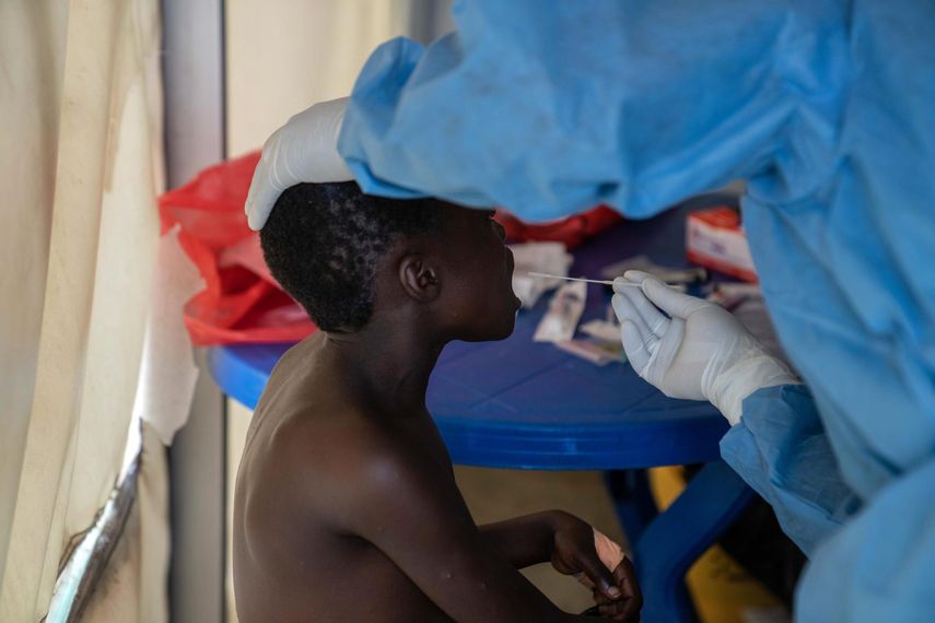 Viruela del mono (mpox)