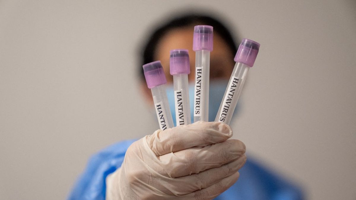 Argentina pone a disposición pruebas de hantavirus Argentina pone a disposición pruebas de hantavirus