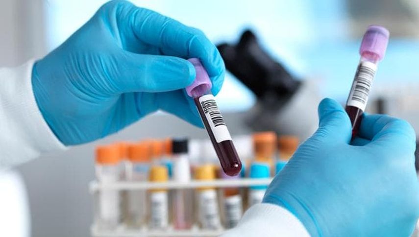 El Ministerio de Salud (Minsa), a través del Departamento de Epidemiología, ha confirmado 243 casos del virus Oropouche en las regiones de Darién y Panamá Este hasta la semana epidemiológica N° 11 de 2024. El Ministerio de Salud (Minsa), a través del Departamento de Epidemiología, ha confirmado 243 casos del virus Oropouche en las regiones de Darién y Panamá Este hasta la semana epidemiológica N° 11 de 2024.