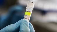 francia anuncia un caso de hantavirus andes en un turista franco-argentino