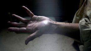 Bolivia: estudiantes crean gel de coca que alivia dolores de chikungunya