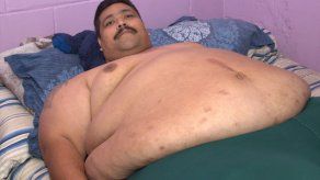 Operarán en México al hombre más obeso del mundo