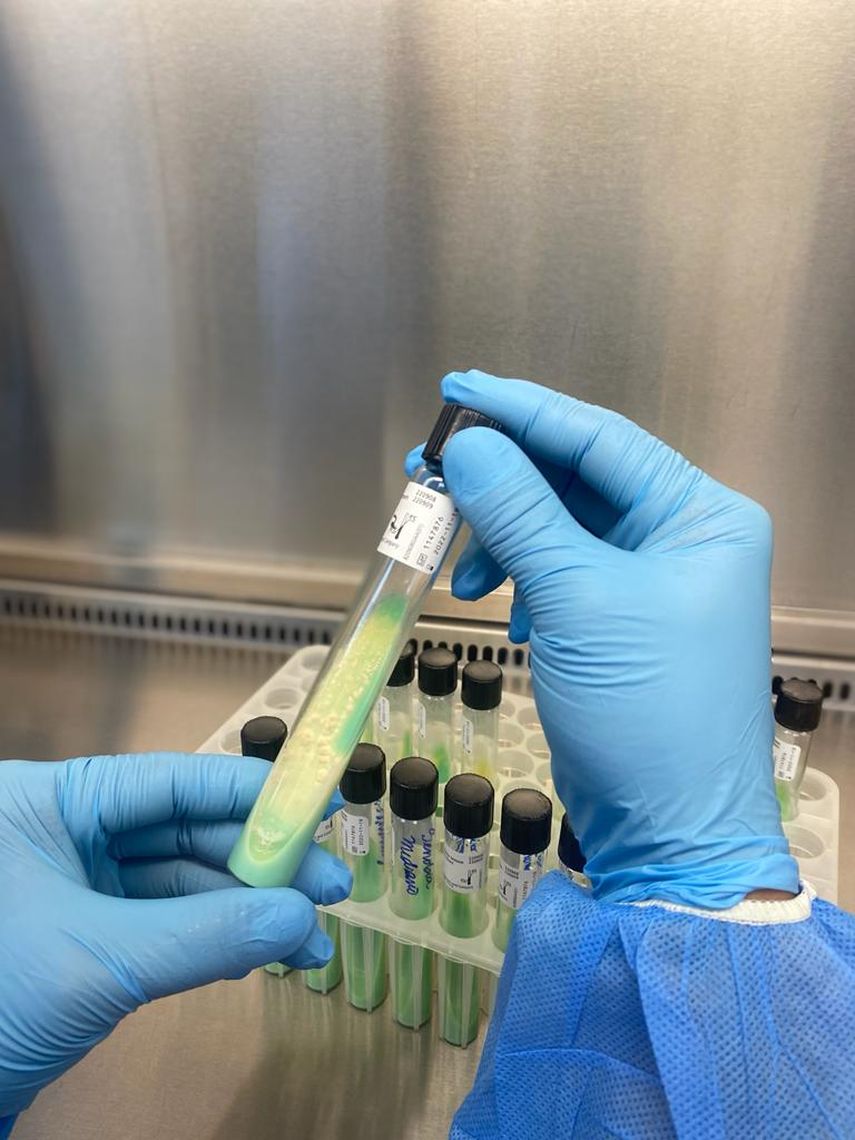 El Ministerio de Salud (Minsa) intensifica sus esfuerzos para combatir la tuberculosis en Panamá, con acciones orientadas al diagnóstico temprano, tratamiento oportuno y reducción de la mortalidad asociada a esta enfermedad. El Ministerio de Salud (Minsa) intensifica sus esfuerzos para combatir la tuberculosis en Panamá, con acciones orientadas al diagnóstico temprano, tratamiento oportuno y reducción de la mortalidad asociada a esta enfermedad.