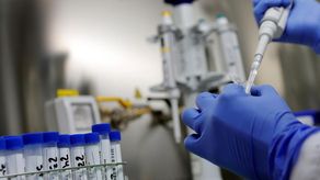 Panamá confirma dos nuevos casos de viruela símica