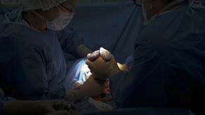 Las cesáreas aumentan en Puerto Rico y alcanzan una tasa récord en el territorio