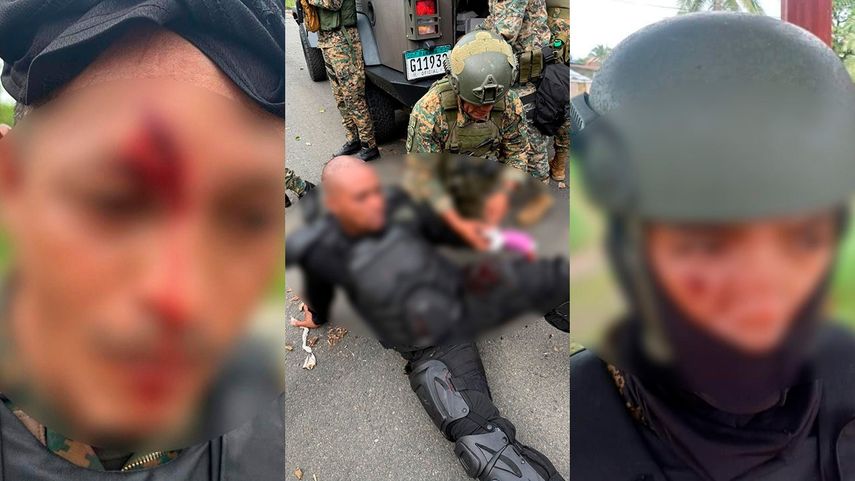 Tres agentes del Senafront resultaron heridos en los enfrentamientos en Arimae. Tres agentes del Senafront resultaron heridos en los enfrentamientos en Arimae.