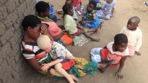 Aumenta el asesinato de albinos en Malaui