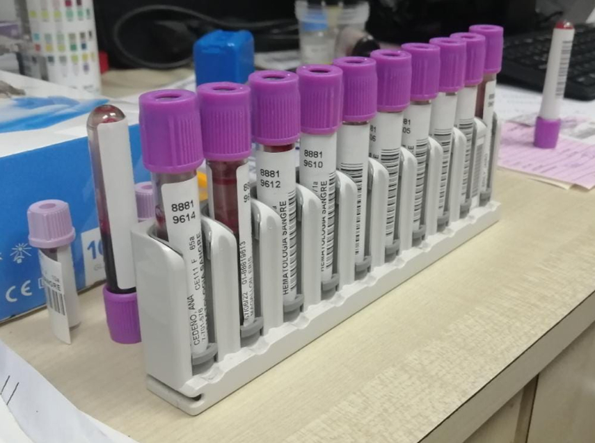El mieloma múltiple es un cáncer de la sangre que afecta un tipo de glóbulos blancos llamados células plasmáticas. El mieloma múltiple es un cáncer de la sangre que afecta un tipo de glóbulos blancos llamados células plasmáticas.