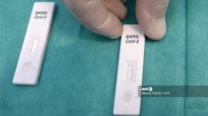 Las pruebas rápidas fracasaron en Italia frente al segundo brote de covid-19