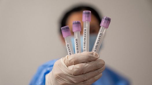 Argentina pone a disposición pruebas de hantavirus Argentina pone a disposición pruebas de hantavirus