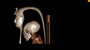 Investigadores egipcios descubren secretos de una momia sin retirarle las vendas