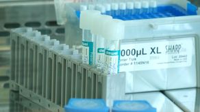 En Chiriquí este año se han detectado infantes de uno y tres años con tuberculosis que son monitoreados de forma ambulatoria por la red integral de salud según indicó el Minsa.