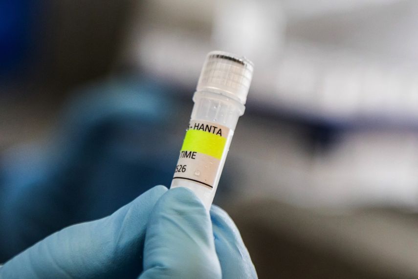Minsa pide evitar rumores sobre posible caso de hantavirus en Los Santos. Minsa pide evitar rumores sobre posible caso de hantavirus en Los Santos.