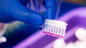 Tres variantes del coronavirus halladas en 14 países de las Américas