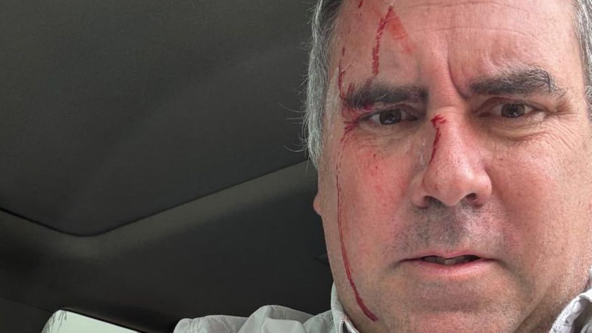 El candidato presidencial del partido peruano Libertad Popular, el empresario Rafael Belaúnde Llosa, sobrevivió este martes a un atentado tras ser atacado a tiros cuando se desplazaba por el distrito de Cerro Azul, en el sur de Lima, Perú, según denunció un portavoz de su movimiento político. El candidato presidencial del partido peruano Libertad Popular, el empresario Rafael Belaúnde Llosa, sobrevivió este martes a un atentado tras ser atacado a tiros cuando se desplazaba por el distrito de Cerro Azul, en el sur de Lima, Perú, según denunció un portavoz de su movimiento político.