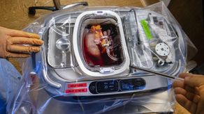 Científicos chinos generan riñones similares a los humanos en cerdos