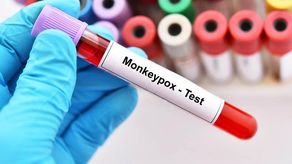 OMS preocupada por una nueva cepa de la viruela del mono