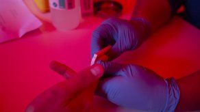 Es factible una cura contra el virus del Sida