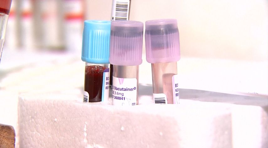 Hepatitis aguda en los niños, un fenómeno aún inexplicado