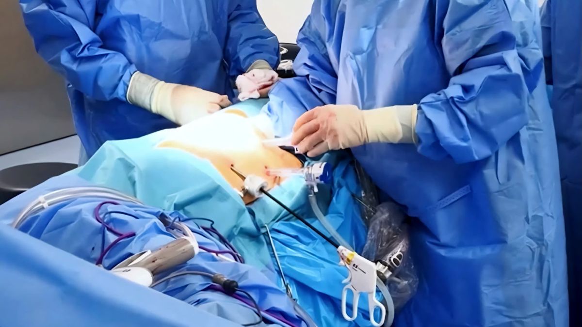 Un nuevo avance médico se registró en la Ciudad de la Salud con la realización del primer trasplante de riñón de un donante fallecido al que previamente se le corrigió quirúrgicamente un aneurisma en la arteria renal, procedimiento que permitió beneficiar a una paciente de 15 años diagnosticada con enfermedad renal crónica. Un nuevo avance médico se registró en la Ciudad de la Salud con la realización del primer trasplante de riñón de un donante fallecido al que previamente se le corrigió quirúrgicamente un aneurisma en la arteria renal, procedimiento que permitió beneficiar a una paciente de 15 años diagnosticada con enfermedad renal crónica.
